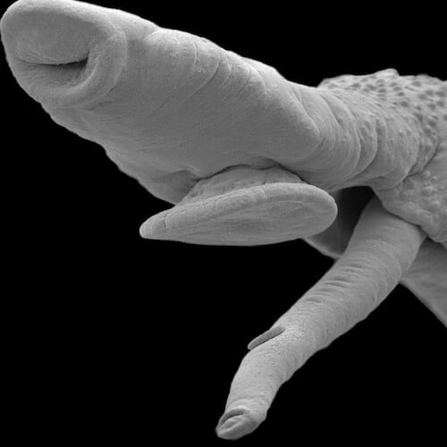 Scanning Electron Micrograph of a male and female worm